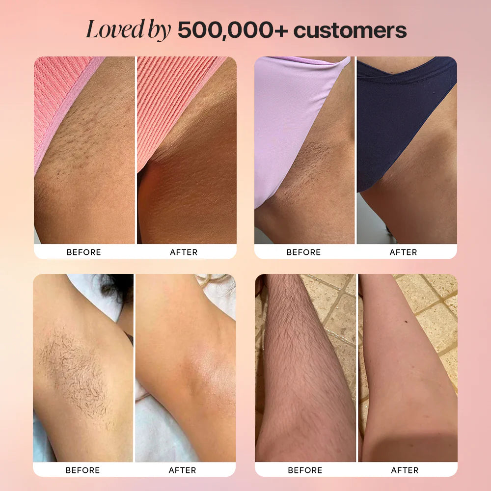 Vellune Smooth Trim